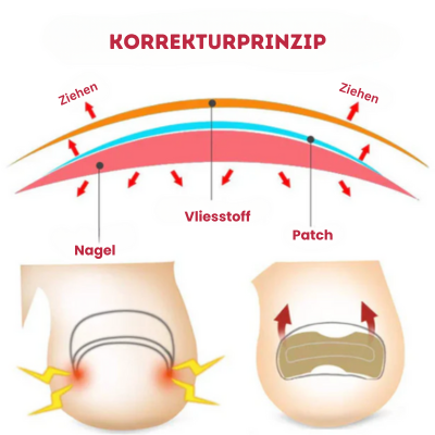 NailFix - Pflegeaufkleber für Nagelkorrekturen