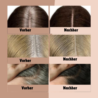 StrandStyler™ - Haarlinien-Pulver | 1+1 GRATIS