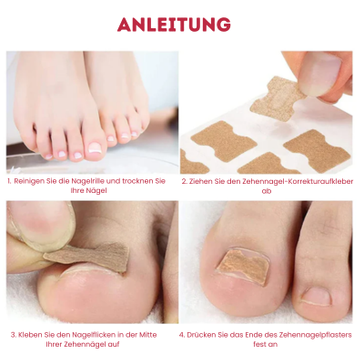 NailFix - Pflegeaufkleber für Nagelkorrekturen