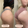 Sculptra - Perfekt konturierte Körperform
