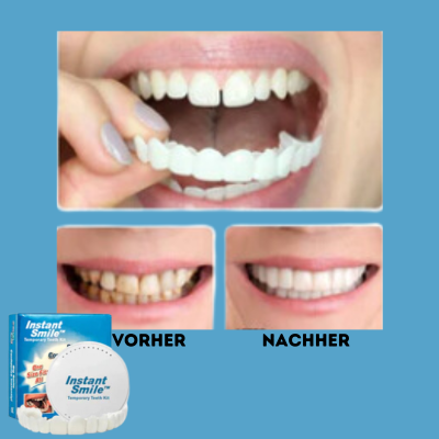 DentaLuxe - Perfektes Lächeln Makeover
