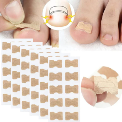 NailFix - Pflegeaufkleber für Nagelkorrekturen
