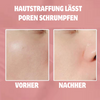 YouthEssence™ | Kollagen-Stick
