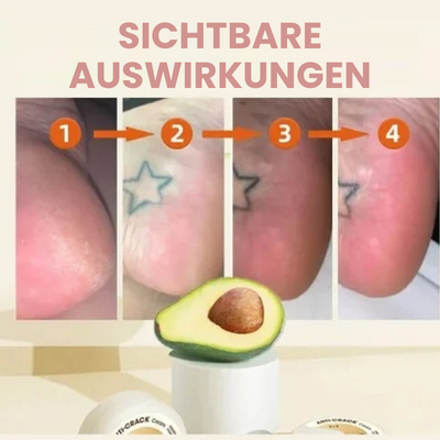 SkinReplenish™ | Anti-Riss-Creme