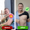 BracePro - Orthopädische Kompressions-Schulterbandage