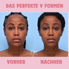 ContourV- Gesichtsabsaugtrainer