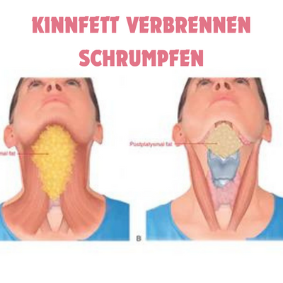 ContourV- Gesichtsabsaugtrainer