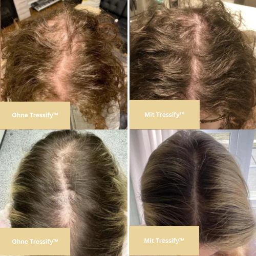 GrowEssence - Ihre natürliche Ölbehandlung für Haarwuchs