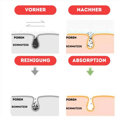 BackEase - Revitalisiert und entspannt müde Rückenmuskeln